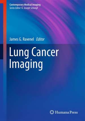 Lung Cancer Imaging de James G. Ravenel