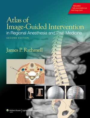 Atlas of Image-Guided Intervention in Regional Anesthesia and Pain Medicine de James P. Rathmell MD