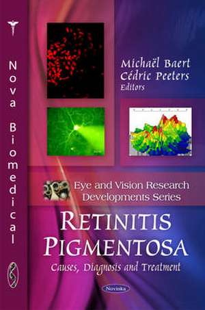 Retinitis Pigmentosa de Michael Baert