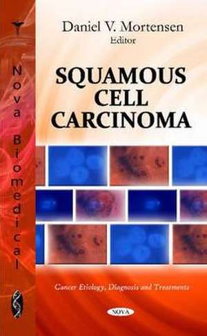 Squamous Cell Carcinoma de Daniel V. Mortensen