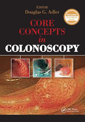 Core Concepts in Colonoscopy de Douglas Adler