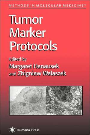 Tumor Marker Protocols de Margaret Hanausek