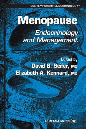 Menopause: Endocrinology and Management de David B. Seifer