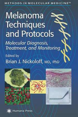 Melanoma Techniques and Protocols: Molecular Diagnosis, Treatment, and Monitoring de Brian J. Nickoloff