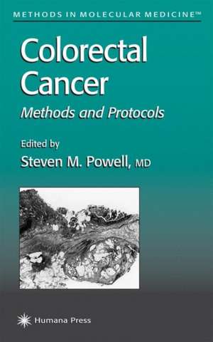 Colorectal Cancer: Methods and Protocols de Steven M. Powell