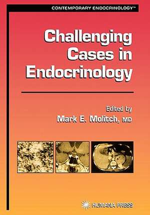 Challenging Cases in Endocrinology de Mark E. Molitch