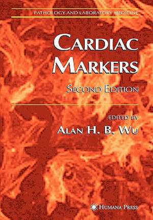 Cardiac Markers de Alan H. B. Wu