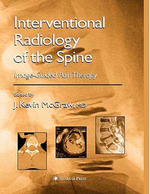 Interventional Radiology of the Spine: Image-Guided Pain Therapy de J. Kevin McGraw