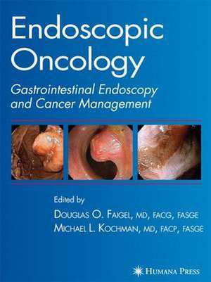 Endoscopic Oncology de Douglas O. Faigel