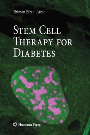 Stem Cell Therapy for Diabetes de Shimon Efrat