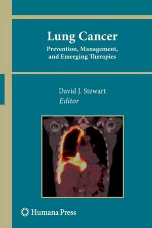 Lung Cancer:: Prevention, Management, and Emerging Therapies de David J. Stewart