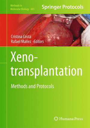 Xenotransplantation: Methods and Protocols de Cristina Costa