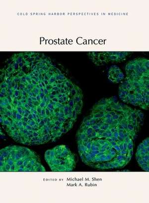 Prostate Cancer de Shen, Michael M.