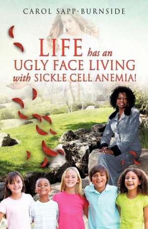 Life Has an Ugly Face Living with Sickle Cell Anemia! de Carol Sapp-Burnside