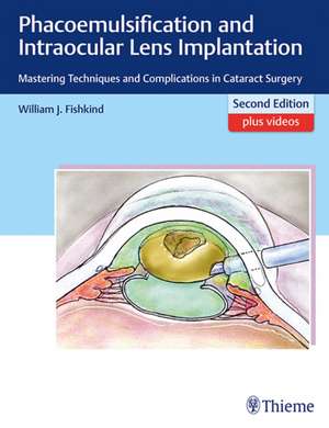 Phacoemulsification and Intraocular Lens Implant – Mastering Techniques and Complications in Cataract Surgery de William J. Fishkind