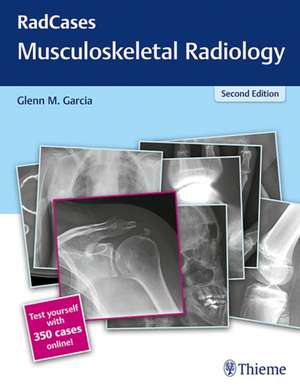 RadCases Q&A Musculoskeletal Radiology books-express.ro