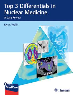 Top 3 Differentials in Nuclear Medicine – A Case Review de Ely A. Wolin