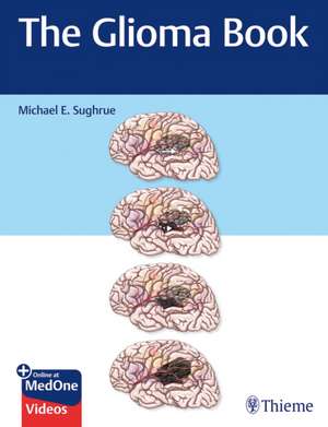 The Glioma Book de M Sughrue