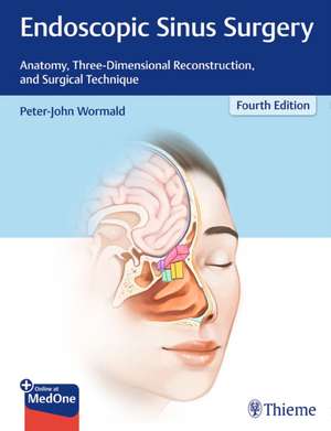 Endoscopic Sinus Surgery – Anatomy, Three–Dimensional Reconstruction, and Surgical Technique de Peter J. Wormald