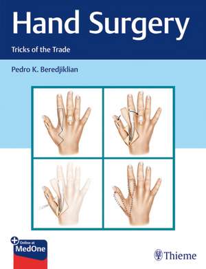 Hand Surgery de P Beredjiklian