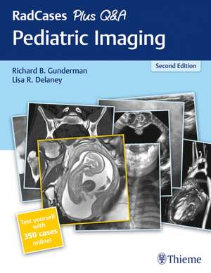 RadCases Plus Q&A Pediatric Imaging de Richard B. Gunderman