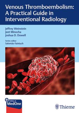 Practical Guides in Interventional Radiology – Venous Thromboembolism de Jeffrey Weinstein