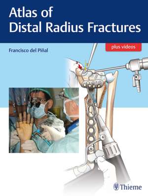 Atlas of Distal Radius Fractures de Francisco Del Pinal