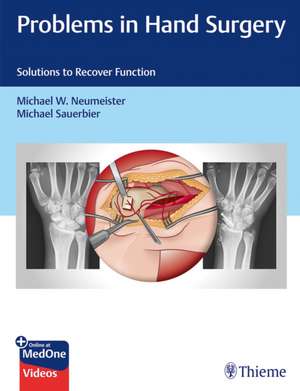 Problems in Hand Surgery – Solutions to Recover Function de Michael Neumeister