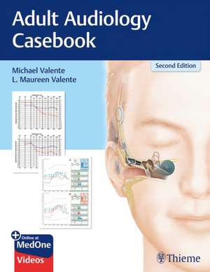 Adult Audiology Casebook de Michael Valente