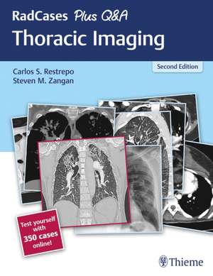 RadCases Plus Q&A Thoracic Imaging de Carlos S. Restrepo