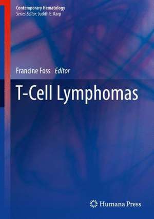 T-Cell Lymphomas de Francine Foss