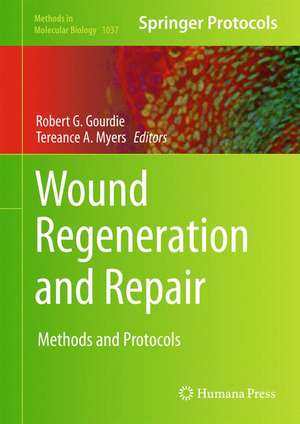 Wound Regeneration and Repair: Methods and Protocols de Robert G. Gourdie