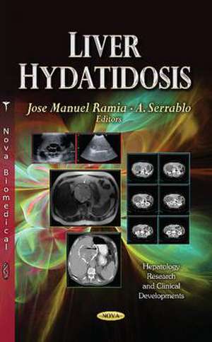 Liver Hydatidosis de Jose Manuel Ramia