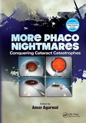 More Phaco Nightmares: Conquering Cataract Catastrophes de Amar Agarwal