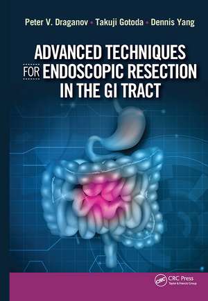 Advanced Techniques for Endoscopic Resection in the GI Tract de Peter Draganov