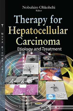 Therapy for Hepatocellular Carcinoma de Nobuhiro Ohkohchi