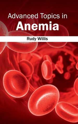 Advanced Topics in Anemia de Rudy Willis