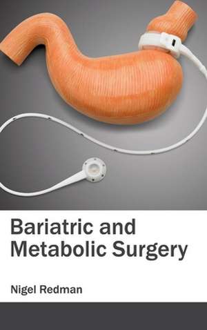 Bariatric and Metabolic Surgery de Nigel Redman