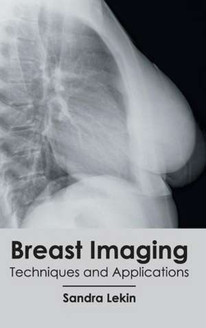 Breast Imaging de Sandra Lekin