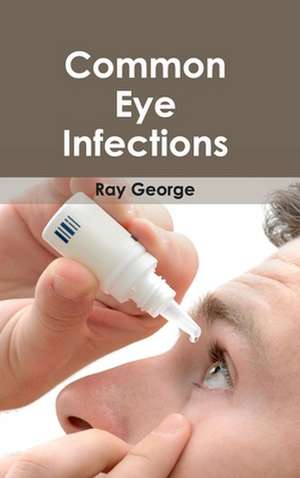 Common Eye Infections de Ray George