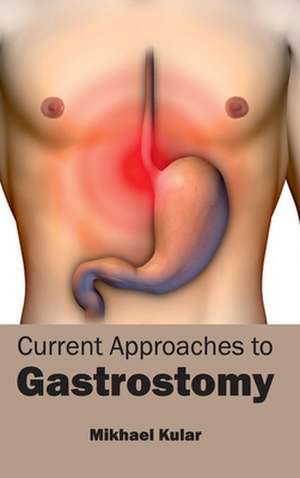 Current Approaches to Gastrostomy de Mikhael Kular