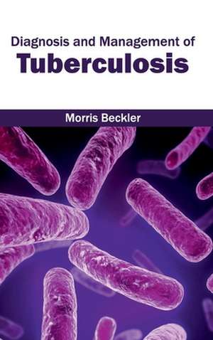 Diagnosis and Management of Tuberculosis de Morris Beckler