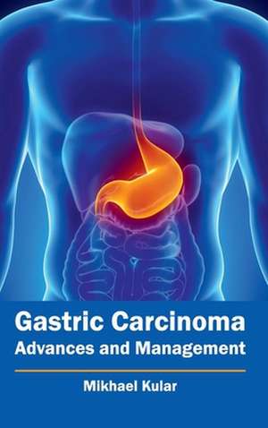 Gastric Carcinoma de Mikhael Kular