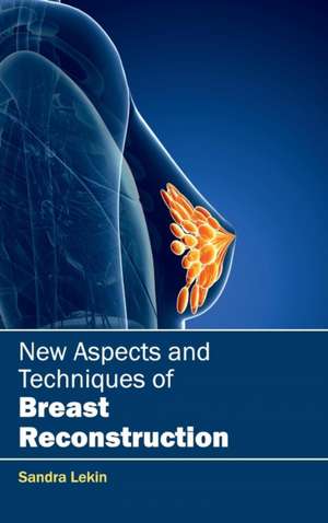 New Aspects and Techniques of Breast Reconstruction de Sandra Lekin