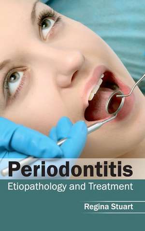 Periodontitis de Regina Stuart