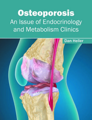 Osteoporosis: An Issue of Endocrinology and Metabolism Clinics de Dan Heller