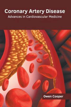 Coronary Artery Disease: Advances in Cardiovascular Medicine de Owen Cooper