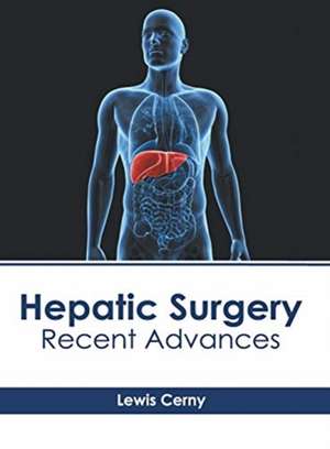 Hepatic Surgery: Recent Advances de Lewis Cerny