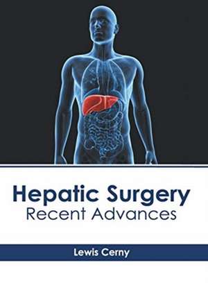 Hepatic Surgery de Lewis Cerny