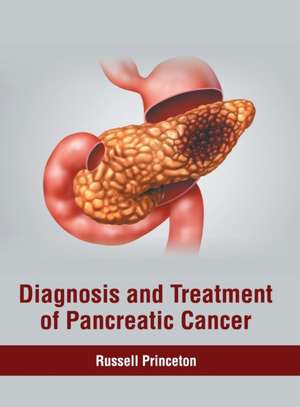 Diagnosis and Treatment of Pancreatic Cancer de Russell Princeton